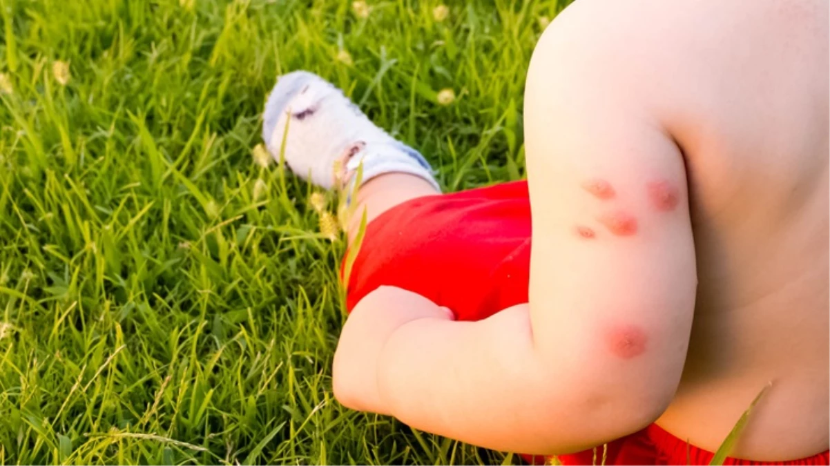 KKTC’de Batı Nil Virüsü vakası tespit edildi! Aşı veya ilaçla tedavisi bulunmuyor