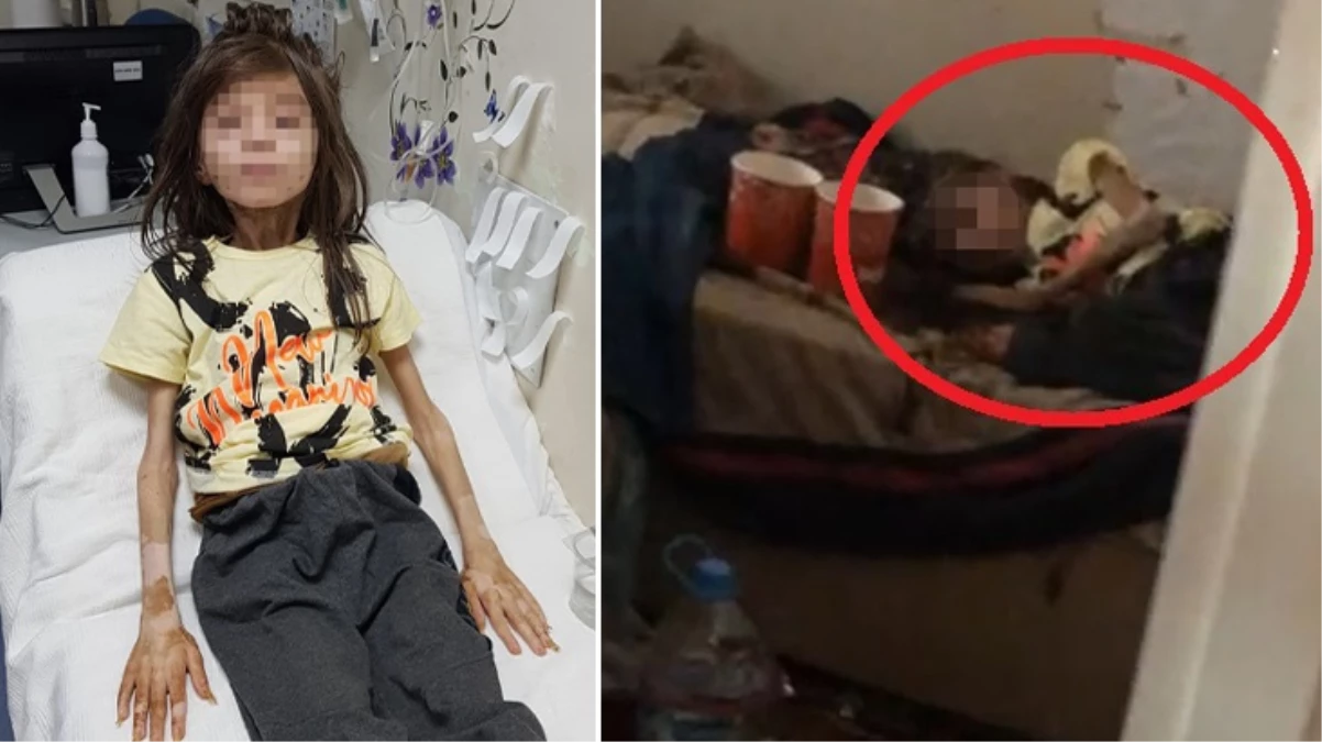 Çöp evde bulunmuştu! İsmini değiştirmeye hazırlanan Cem Muhammet’in son halini görenler gözlerine inanamıyor