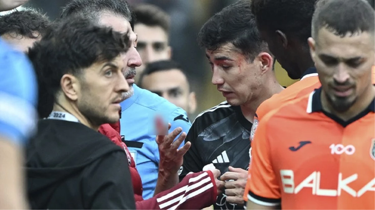 Göz çukuru kırıldı! Beşiktaşlı Bakhtiyor Zaynutdinov’un yüzü tanınmayacak hale geldi