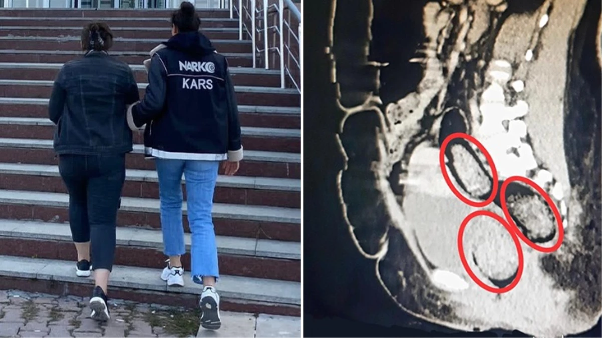 Kars’ta otobüste yakalanan İran uyruklu kadının makatından uyuşturucu çıktı