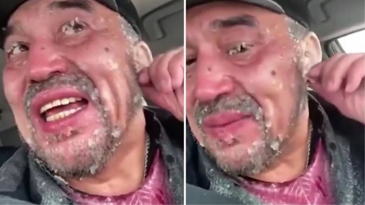 Eksi 50 dereceyi gören Yakutsk’de sıkı giyinmeyen adamın kirpikleri ve kulağı buz tuttu