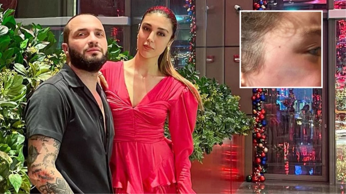 Kızlarının yüzüne mobilya düşmüştü! Berkay’ın eşi duruşmada öfke kustu: Çocuğum travma yaşadı, eşyaları çöpe attım