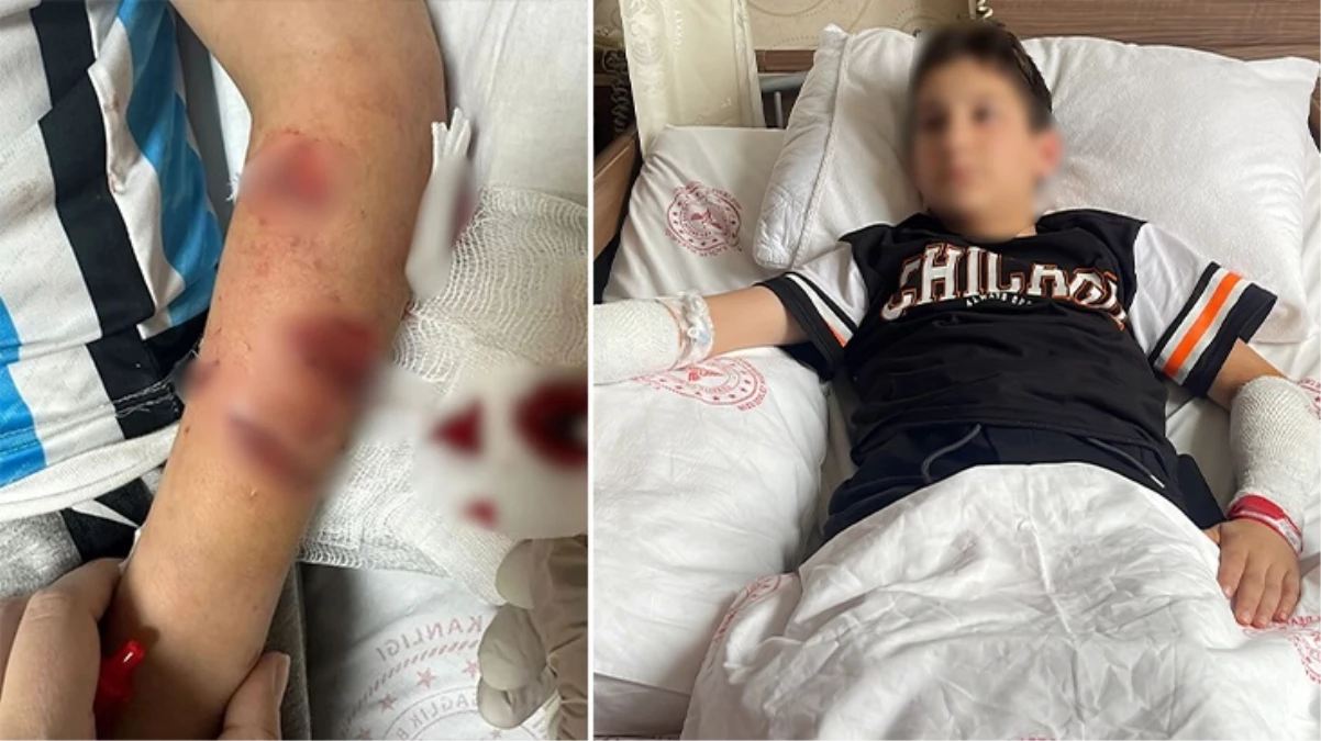 Rize’de başıboş sokak köpeği 12 yaşındaki çocuğa saldırdı