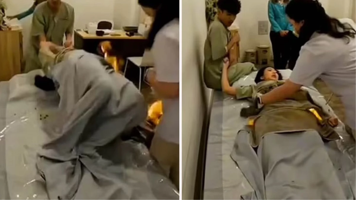 Taylandlı model Game, tedavi sırasında alevler içinde kaldı