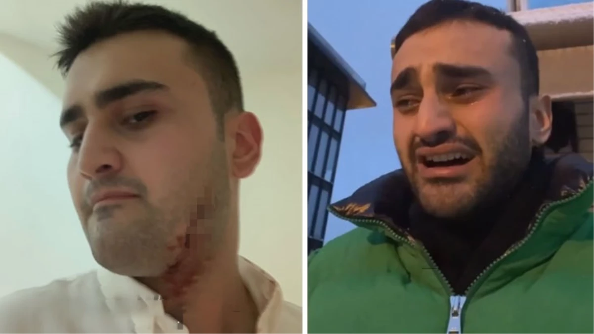 CZN Burak’ın vücudu kesikler içinde! Son hali herkesi korkuttu