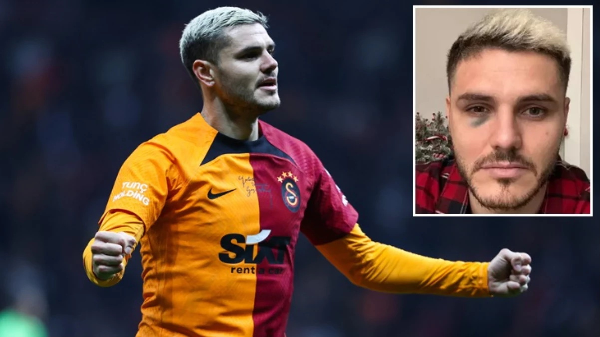 Galatasaray’da Mauro Icardi depremi! Bir süre yeşil sahalardan uzak kalacak