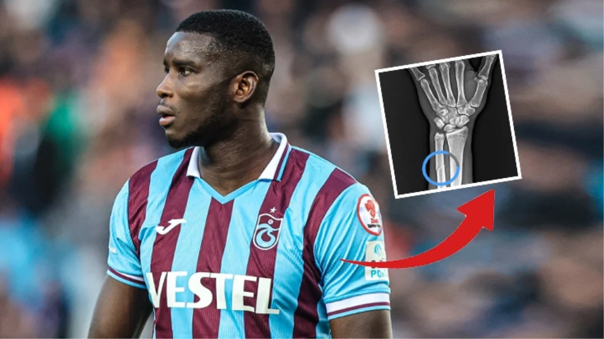 Trabzonspor Onuachu’da kırık tespit edildiğini açıkladı: VAR’da göremediğiniz pozisyonun röntgen görüntüsü
