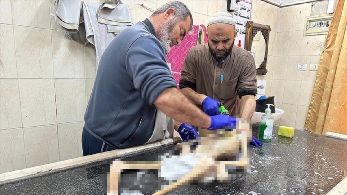 Gazze'de yeterli beslenemeyen 10 yaşındaki çocuk bir deri bir kemik halde öldü