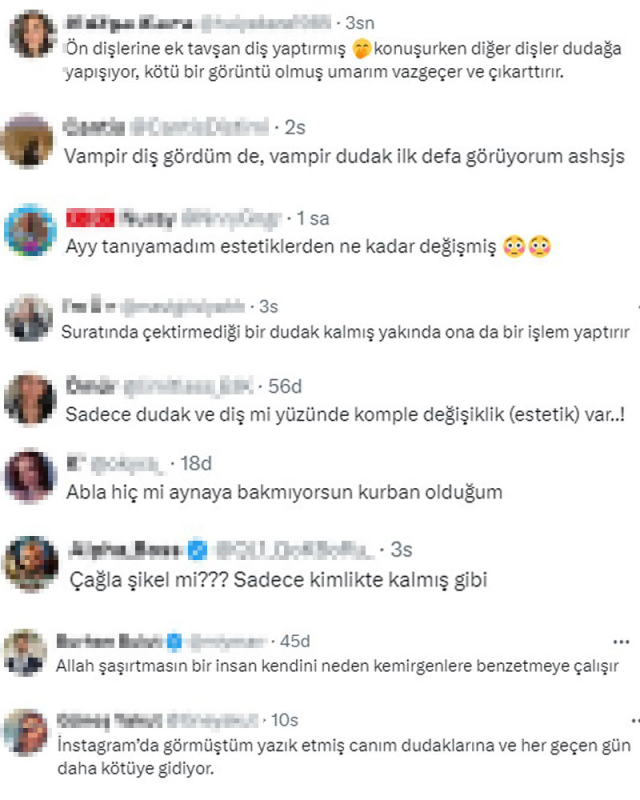 Estetiğin dozunu kaçıran Çağla Şıkel'in son hali alay konusu oldu