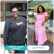 Gugu Gumede’nin Tüp Mide Ameliyatı: 30 Kilo Verdi